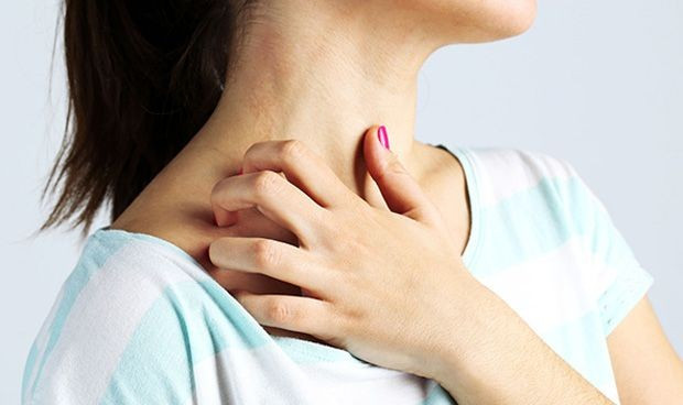 Asocian el crecimiento de las bacterias con la dermatitis atopica 3623 620x368
