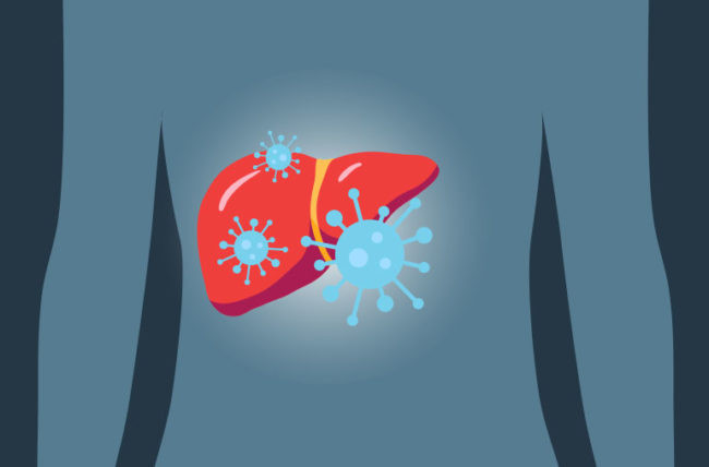 HepatitisCliver