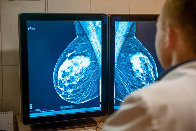 Cómo lograr una mayor precisión en la cirugía conservadora del cáncer de mama