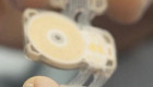 Implantan los primeros chips contra la apnea del sueño controlados desde una aplicación