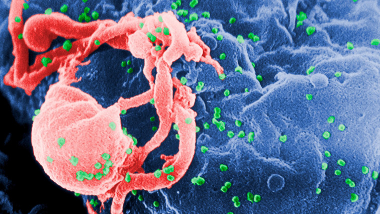 Investigadores aportan nuevos conocimientos sobre la regulación genética del virus causante del sida
