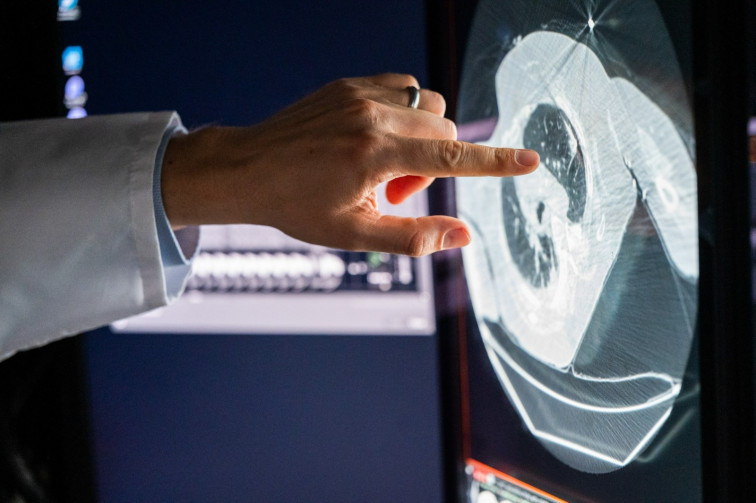 Terapia dirigida vs inmunoterapia para el cáncer