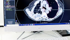 Sociedad Radiología denuncia entidades forman “radiólogos” en cursos a vapor