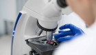 La falta de una proteína inicia el cáncer de colon en ratones