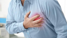 Cuando el corazón late de forma irregular, el riesgo de un derrame cerebral aumenta