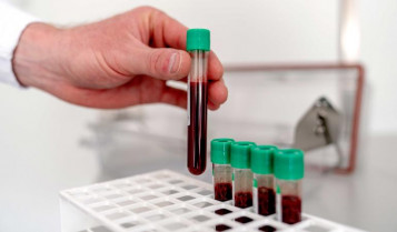 Todos los habitantes de este país tienen 'químicos eternos' en su sangre