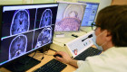 Revelan cómo el cerebro organiza y dirige su actividad más lenta