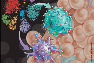 Cómo las células inmunitarias se convierten en cómplices del tumor