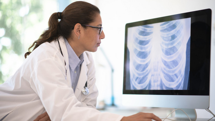 Detectar a tiempo el cáncer de pulmón puede marcar la diferencia en su tratamiento