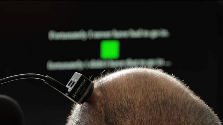 Implante cerebral devuelve la voz a paciente con ELA en tiempo real