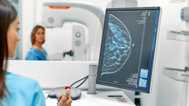 Una vacuna “a la medida” busca cambiar el pronóstico del cáncer de mama más agresivo