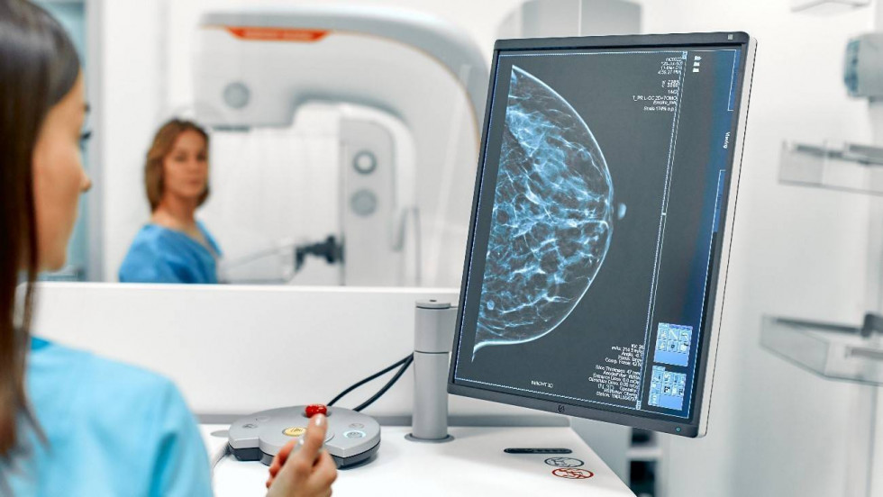 Una vacuna “a la medida” busca cambiar el pronóstico del cáncer de mama más agresivo