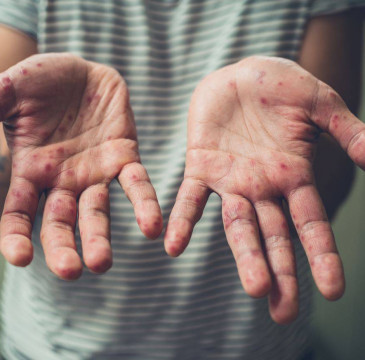 Zamora guarda silencio por las víctimas del atentado de Barcelona 