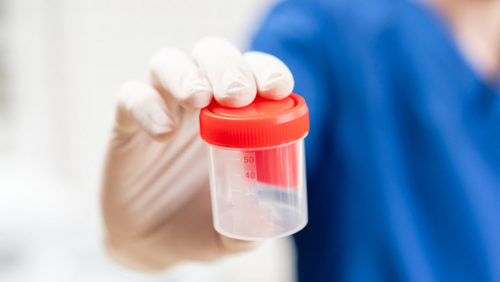 Detectan el primer caso en el mundo de una rara enfermedad transmitida por donación de esperma