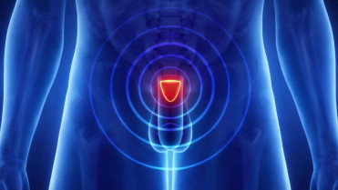 Un nuevo dispositivo de terapia láser logra controlar el cáncer de próstata con menos secuelas