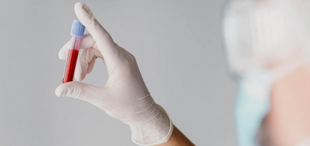 Una nueva prueba rastrea la vida útil de la sangre donada para su uso clínico