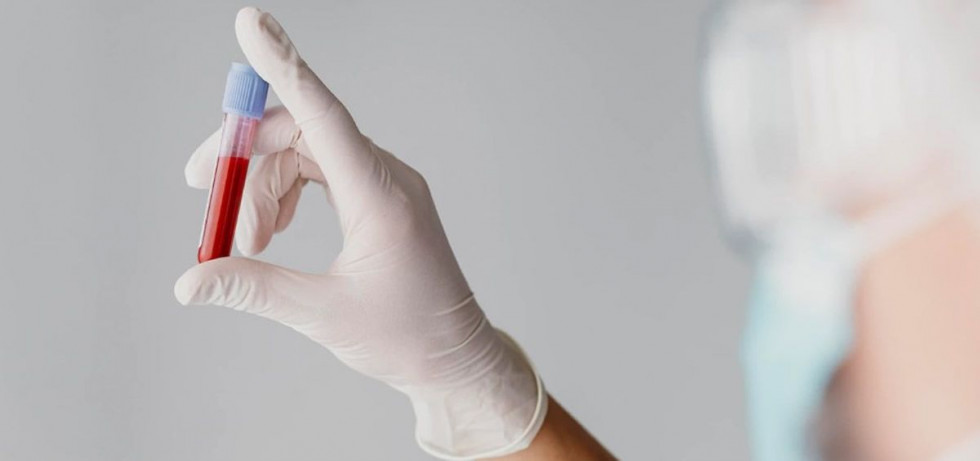 Una nueva prueba rastrea la vida útil de la sangre donada para su uso clínico