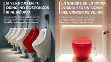 Sangre en orina, la señal que podría detectar el cáncer de vejiga a tiempo